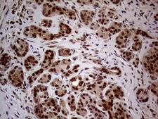 NSD3 / WHSC1L1 Antibody - Immunohistochemical staining of paraffin-embedded Human pancreas tissue within the normal limits using anti-WHSC1L1 mouse monoclonal antibody. (Heat-induced epitope retrieval by 1mM EDTA in 10mM Tris buffer. (pH8.5) at 120°C for 3 min. (1:500)