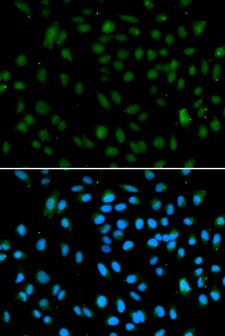 NSD3 / WHSC1L1 Antibody - Immunofluorescence analysis of A549 cell using WHSC1L1 antibody. Blue: DAPI for nuclear staining.