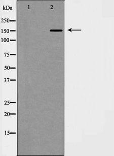 NSD3 / WHSC1L1 Antibody - Western blot analysis of HeLa cell lysates using WHSC1L1 antibody. The lane on the left is treated with the antigen-specific peptide.