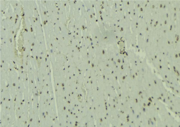 NSD3 / WHSC1L1 Antibody - 1:100 staining mouse muscle tissue by IHC-P. The sample was formaldehyde fixed and a heat mediated antigen retrieval step in citrate buffer was performed. The sample was then blocked and incubated with the antibody for 1.5 hours at 22°C. An HRP conjugated goat anti-rabbit antibody was used as the secondary.