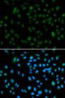 NSD3 / WHSC1L1 Antibody - Immunofluorescence analysis of A549 cells using WHSC1L1 Polyclonal Antibody.