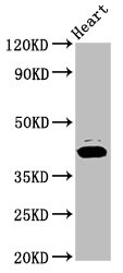 NSDHL Antibody - Positive Western Blot detected in Rat heart tissue. All lanes: NSDHL antibody at 7.2 µg/ml Secondary Goat polyclonal to rabbit IgG at 1/50000 dilution. Predicted band size: 42 KDa. Observed band size: 42 KDa