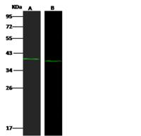 NSDHL Antibody - Anti-NSDHL rabbit polyclonal antibody at 1:500 dilution. Lane A: A431 Whole Cell Lysate. Lane B: HepG2 Whole Cell Lysate. Lysates/proteins at 30 ug per lane. Secondary: Goat Anti-Rabbit IgG H&L (Dylight 800) at 1/10000 dilution. Developed using the Odyssey technique. Performed under reducing conditions. Predicted band size: 42 kDa. Observed band size: 39 kDa.