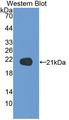 NSF Antibody - Western blot of NSF antibody.