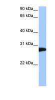 NSF Antibody - NSF antibody Western blot of brain lysate. This image was taken for the unconjugated form of this product. Other forms have not been tested.