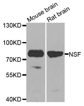 NSF Antibody - Western blot analysis of extracts of various cell lines, using NSF antibody at 1:1000 dilution. The secondary antibody used was an HRP Goat Anti-Rabbit IgG (H+L) at 1:10000 dilution. Lysates were loaded 25ug per lane and 3% nonfat dry milk in TBST was used for blocking. An ECL Kit was used for detection and the exposure time was 15s.
