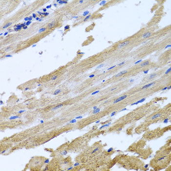 NSF Antibody - Immunohistochemistry of paraffin-embedded rat heart using NSF antibodyat dilution of 1:100 (40x lens).