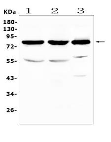 NSF Antibody - Western blot analysis of NSF using anti-NSF antibody. Electrophoresis was performed on a 5-20% SDS-PAGE gel at 70V (Stacking gel) / 90V (Resolving gel) for 2-3 hours. The sample well of each lane was loaded with 50ug of sample under reducing conditions. Lane 1: rat brain tissue lysates,Lane 2: mouse brain tissue lysates,Lane 3: human HepG2 cell lysates. After Electrophoresis, proteins were transferred to a Nitrocellulose membrane at 150mA for 50-90 minutes. Blocked the membrane with 5% Non-fat Milk/ TBS for 1.5 hour at RT. The membrane was incubated with rabbit anti-NSF antigen affinity purified polyclonal antibody at 0.5 µg/mL overnight at 4°C, then washed with TBS-0.1% Tween 3 times with 5 minutes each and probed with a goat anti-rabbit IgG-HRP secondary antibody at a dilution of 1:10000 for 1.5 hour at RT. The signal is developed using an Enhanced Chemiluminescent detection (ECL) kit with Tanon 5200 system. A specific band was detected for NSF at approximately 82KD. The expected band size for NSF is at 82KD.