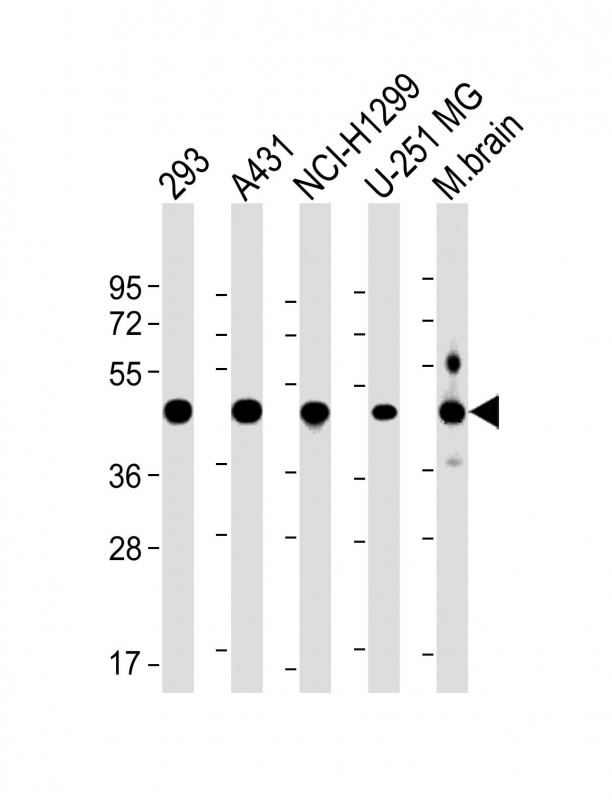 NSFL1C Antibody - All lanes: Anti-NSFL1C Antibody (Center) at 1:2000 dilution Lane 1: 293 whole cell lysate Lane 2: A431 whole cell lysate Lane 3: NCI-H1299 whole cell lysate Lane 4: U-251 MG whole cell lysate Lane 5: Mouse brain lysate Lysates/proteins at 20 µg per lane. Secondary Goat Anti-Rabbit IgG, (H+L), Peroxidase conjugated at 1/10000 dilution. Predicted band size: 41 kDa Blocking/Dilution buffer: 5% NFDM/TBST.