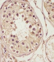 NSFL1C Antibody - NSFL1C Antibody (Center) staining NSFL1C in human testis tissue sections by Immunohistochemistry (IHC-P - paraformaldehyde-fixed, paraffin-embedded sections). Tissue was fixed with formaldehyde and blocked with 3% BSA for 0. 5 hour at room temperature; antigen retrieval was by heat mediation with a citrate buffer (pH6). Samples were incubated with primary antibody (1/25) for 1 hours at 37°C. A undiluted biotinylated goat polyvalent antibody was used as the secondary antibody.