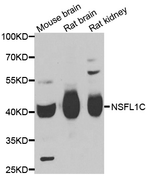 NSFL1C Antibody - Western blot analysis of extracts of various cell lines.