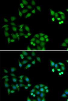 NSFL1C Antibody - Immunofluorescence analysis of HeLa cells.