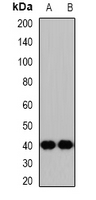 NSFL1C Antibody - Western blot analysis of p47 expression in mouse brain (A); rat kidney (B) whole cell lysates.