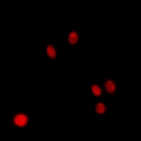 NSFL1C Antibody - Immunofluorescent analysis of p47 staining in HeLa cells. Formalin-fixed cells were permeabilized with 0.1% Triton X-100 in TBS for 5-10 minutes and blocked with 3% BSA-PBS for 30 minutes at room temperature. Cells were probed with the primary antibody in 3% BSA-PBS and incubated overnight at 4 deg C in a humidified chamber. Cells were washed with PBST and incubated with a DyLight 594-conjugated secondary antibody (red) in PBS at room temperature in the dark.