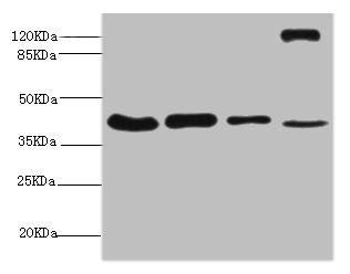 NSFL1C Antibody - Western blot All Lanes:NSFL1C antibody at 6.3ug/ml Lane 1:mouse brain tissue Lane 2:A431 whole cell lysate Lane 3:293T whole cell lysate Lane 4:Rat liver tissue Secondary Goat polyclonal to rabbit at 1/10000 dilution Predicted band size: 41,38,29 kDa Observed band size: 41 kDa,130 kDa