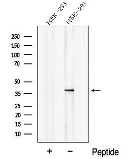 NSFL1C Antibody - Western blot analysis of extracts of HEK293 cells using NSFL1C antibody. The lane on the left was treated with blocking peptide.