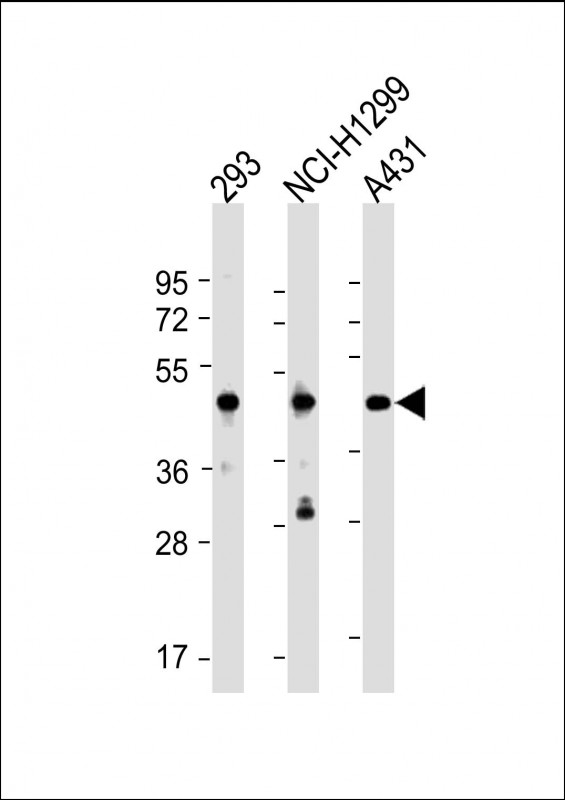 NSFL1C Antibody - All lanes: Anti-NSFL1C Antibody (N-Term) at 1:2000 dilution Lane 1: 293 whole cell lysate Lane 2: NCI-H1299 whole cell lysate Lane 3: A431 whole cell lysate Lysates/proteins at 20 µg per lane. Secondary Goat Anti-Rabbit IgG, (H+L), Peroxidase conjugated at 1/10000 dilution. Predicted band size: 41 kDa Blocking/Dilution buffer: 5% NFDM/TBST.