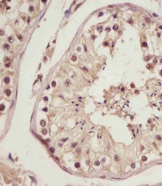 NSFL1C Antibody - NSFL1C Antibody (N-Term) staining NSFL1C in human testis tissue sections by Immunohistochemistry (IHC-P - paraformaldehyde-fixed, paraffin-embedded sections). Tissue was fixed with formaldehyde and blocked with 3% BSA for 0. 5 hour at room temperature; antigen retrieval was by heat mediation with a citrate buffer (pH6). Samples were incubated with primary antibody (1/25) for 1 hours at 37°C. A undiluted biotinylated goat polyvalent antibody was used as the secondary antibody.