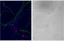 NSG1 Antibody - Nsg1 / Neep21 antibody (3µg/ml) staining of primary DIV9 cells from Hippocampus E18 Rat embryos showed exclusive localization (red, Alexa 568) within the neurons (MAP2 staining in blue, Alexa 647) and not in the glia (GFAP staining in green, Alexa 488). Right panel shows the same cells in phase contrast.