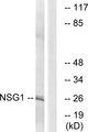 NSG1 Antibody - Western blot analysis of extracts from COLO cells, using NSG1 antibody.