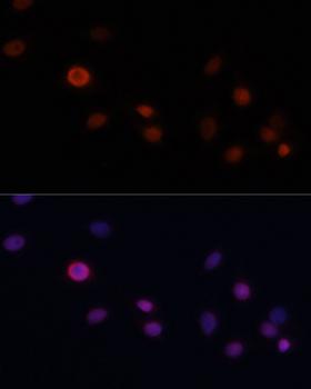 NSG1 Antibody - Immunofluorescence analysis of C6 cells using p21 Polyclonal Antibody at dilution of 1:100.Blue: DAPI for nuclear staining.