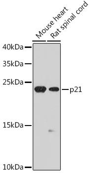 NSG1 Antibody - Western blot analysis of extracts of various cell lines using p21 Polyclonal Antibody at dilution of 1:1000.