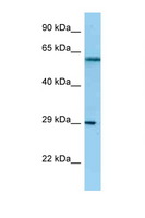 NSL1 Antibody - NSL1 antibody Western blot of HeLa Cell lysate. Antibody concentration 1 ug/ml.  This image was taken for the unconjugated form of this product. Other forms have not been tested.
