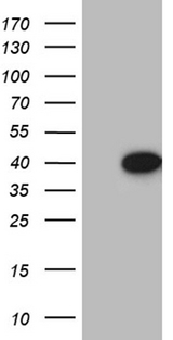 NSL1 Antibody - HEK293T cells were transfected with the pCMV6-ENTRY control. (Left lane) or pCMV6-ENTRY NSL1. (Right lane) cDNA for 48 hrs and lysed