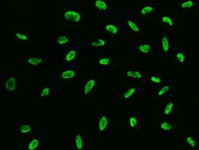 NSL1 Antibody - Immunofluorescence staining of NSL1 in HeLa cells. Cells were fixed with 4% PFA, permeabilzed with 0.1% Triton X-100 in PBS, blocked with 10% serum, and incubated with rabbit anti-human NSL1 polyclonal antibody (dilution ratio 1:5000) at 4°C overnight. Then cells were stained with the Alexa Fluor 488-conjugated Goat Anti-rabbit IgG secondary antibody (green). Positive staining was localized to Nucleus.