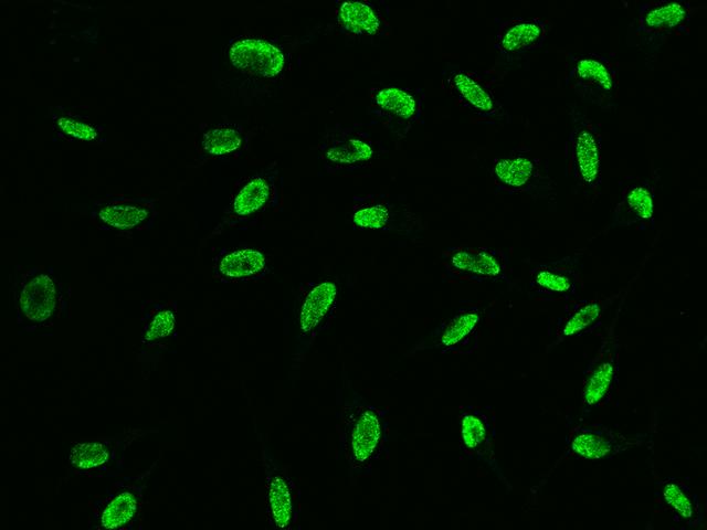 NSL1 Antibody - Immunofluorescence staining of NSL1 in HeLa cells. Cells were fixed with 4% PFA, permeabilzed with 0.1% Triton X-100 in PBS, blocked with 10% serum, and incubated with rabbit anti-human NSL1 polyclonal antibody (dilution ratio 1:5000) at 4°C overnight. Then cells were stained with the Alexa Fluor 488-conjugated Goat Anti-rabbit IgG secondary antibody (green). Positive staining was localized to Nucleus.