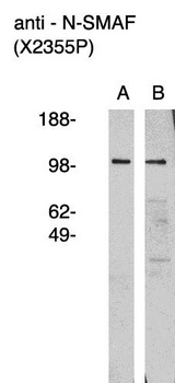 NSMAF Antibody - Western blot of anti nSMAF antibody on human brain lysate (A) and RMS-13 rhabdosarcoma cell lysate (B). Lysate used at 15 ug/lane. Antibody used at 1:400 dilution. Secondary antibody, mouse anti-rabbit HRP, used at 1:50k dilution. Visualized using Pierce West Femto substrate system. Exposure for 5 minutes 