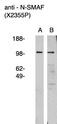 NSMAF Antibody - Western blot of anti nSMAF antibody on human brain lysate (A) and RMS-13 rhabdosarcoma cell lysate (B). Lysate used at 15 ug/lane. Antibody used at 1:400 dilution. Secondary antibody, mouse anti-rabbit HRP, used at 1:50k dilution. Visualized using Pierce West Femto substrate system. Exposure for 5 minutes 