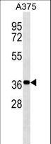 NSMCE1 Antibody - NSMCE1 Antibody western blot of A375 cell line lysates (35 ug/lane). The NSMCE1 Antibody detected the NSMCE1 protein (arrow).