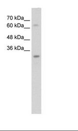 NSMCE1 Antibody - HepG2 Cell Lysate.  This image was taken for the unconjugated form of this product. Other forms have not been tested.