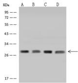 NSMCE1 Antibody - Anti-NSMCE1 rabbit polyclonal antibody at 1:500 dilution. Lane A: Raji Whole Cell Lysate. Lane B: HepG2 Whole Cell Lysate. Lane C: Jurkat Whole Cell Lysate. Lane D: HL-60 Whole Cell Lysate. Lysates/proteins at 30 ug per lane. Secondary: Goat Anti-Rabbit IgG (H+L)/HRP at 1/10000 dilution. Developed using the ECL technique. Performed under reducing conditions. Predicted band size: 31 kDa.
