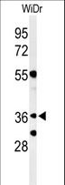 NSMCE4A / NSE4A Antibody - Western blot of NSE4A Antibody in WiDr cell line lysates (35 ug/lane). NSE4A (arrow) was detected using the purified antibody.