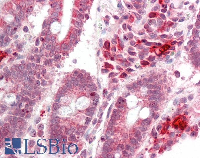 NSMCE4A / NSE4A Antibody - Human Small Intestine: Formalin-Fixed, Paraffin-Embedded (FFPE).  This image was taken for the unconjugated form of this product. Other forms have not been tested.