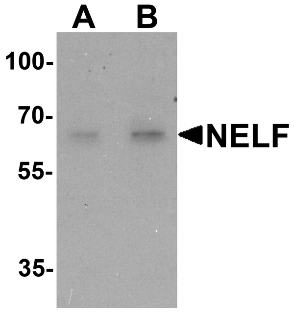 NSMF / NELF Antibody - Western blot analysis of NELF in HeLa cell lysate with NELF antibody at (A) 1 and (B) 2 ug/ml.