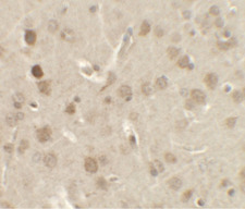 NSMF / NELF Antibody - Immunohistochemistry of NELF in rat brain tissue with NELF antibody at 2.5 ug/ml.