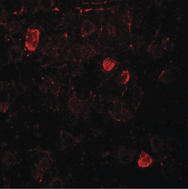 NSMF / NELF Antibody - Immunofluorescence of NELF in rat brain tissue with NELF antibody at 20 ug/ml.