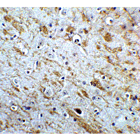 NSMF / NELF Antibody - Immunohistochemistry of NELF in mouse brain tissue with NELF Antibodyat 5 µg/mL.
