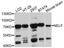 NSMF / NELF Antibody - Western blot analysis of extracts of various cell lines.