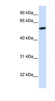 NSMF / NELF Antibody - NELF antibody Western blot of Fetal Liver lysate. This image was taken for the unconjugated form of this product. Other forms have not been tested.