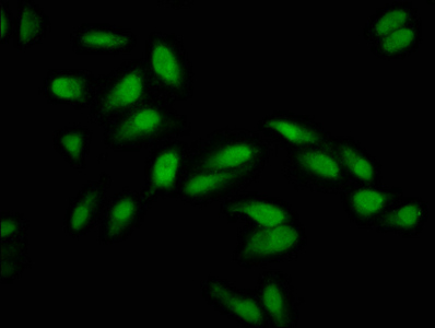 NSPC1 / PCGF1 Antibody - Immunofluorescence staining of Hela cells at a dilution of 1:133, counter-stained with DAPI. The cells were fixed in 4% formaldehyde, permeabilized using 0.2% Triton X-100 and blocked in 10% normal Goat Serum. The cells were then incubated with the antibody overnight at 4 °C.The secondary antibody was Alexa Fluor 488-congugated AffiniPure Goat Anti-Rabbit IgG (H+L) .