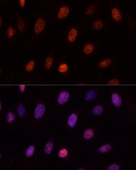 NSPC1 / PCGF1 Antibody - Immunofluorescence analysis of U-2OS cells using PCGF1 Polyclonal Antibody at dilution of 1:100.Blue: DAPI for nuclear staining.