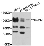 NSUN2 Antibody - Western blot analysis of extracts of various cells.