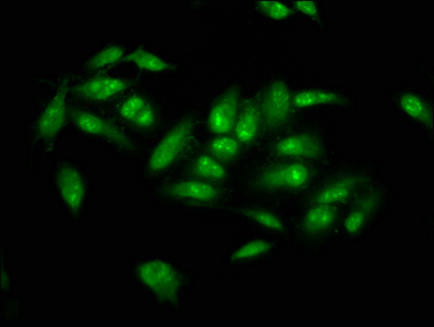 NSUN2 Antibody - Immunofluorescence staining of Hela cells at a dilution of 1:66, counter-stained with DAPI. The cells were fixed in 4% formaldehyde, permeabilized using 0.2% Triton X-100 and blocked in 10% normal Goat Serum. The cells were then incubated with the antibody overnight at 4 °C.The secondary antibody was Alexa Fluor 488-congugated AffiniPure Goat Anti-Rabbit IgG (H+L) .