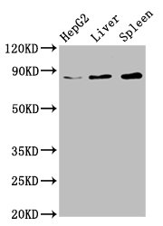 NSUN2 Antibody - Positive Western Blot detected in HepG2 whole cell lysate, Rat liver tissue, Mouse spleen tissue. All lanes: NSUN2 antibody at 6.7 µg/ml Secondary Goat polyclonal to rabbit IgG at 1/50000 dilution. Predicted band size: 87, 83, 60 KDa. Observed band size: 87 KDa