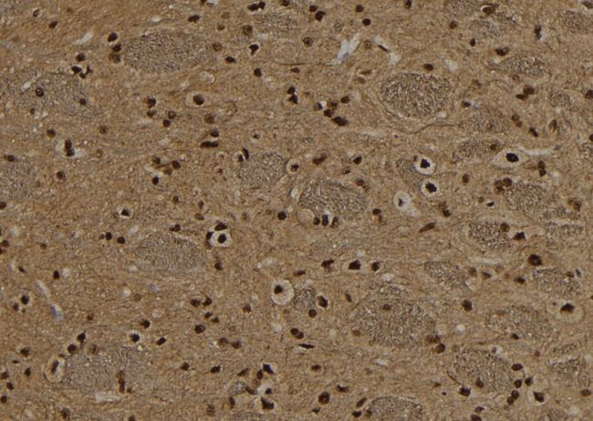 NSUN2 Antibody - 1:100 staining rat brain tissue by IHC-P. The sample was formaldehyde fixed and a heat mediated antigen retrieval step in citrate buffer was performed. The sample was then blocked and incubated with the antibody for 1.5 hours at 22°C. An HRP conjugated goat anti-rabbit antibody was used as the secondary.