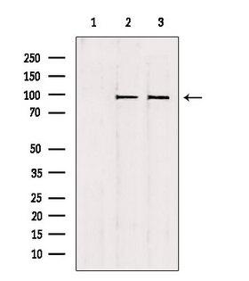 NSUN2 Antibody - Western blot analysis of extracts of various samples using NSUN2 antibody. Lane 1: 293 treated with blocking peptide. Lane 2: 293; Lane 3: HeLa;